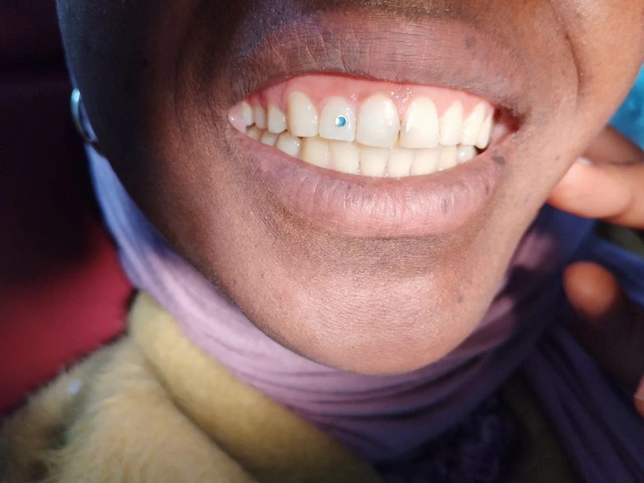 Single tooth gem application