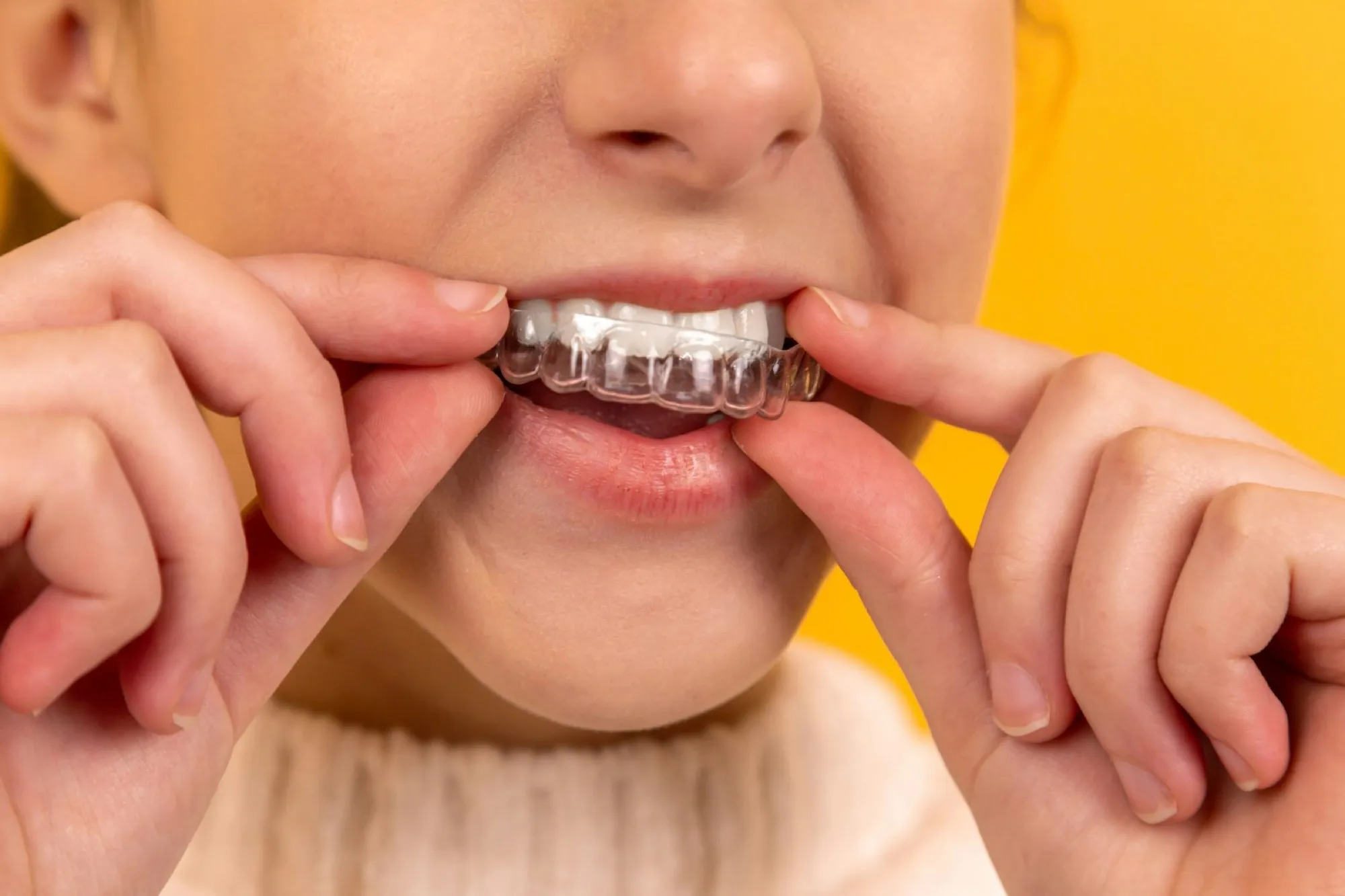 Teeth Protection